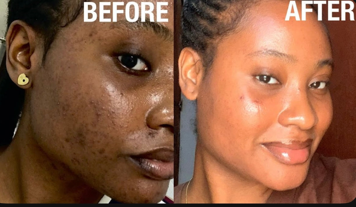 Melanin Skin Care Routine GLO *See Results in less than a week*