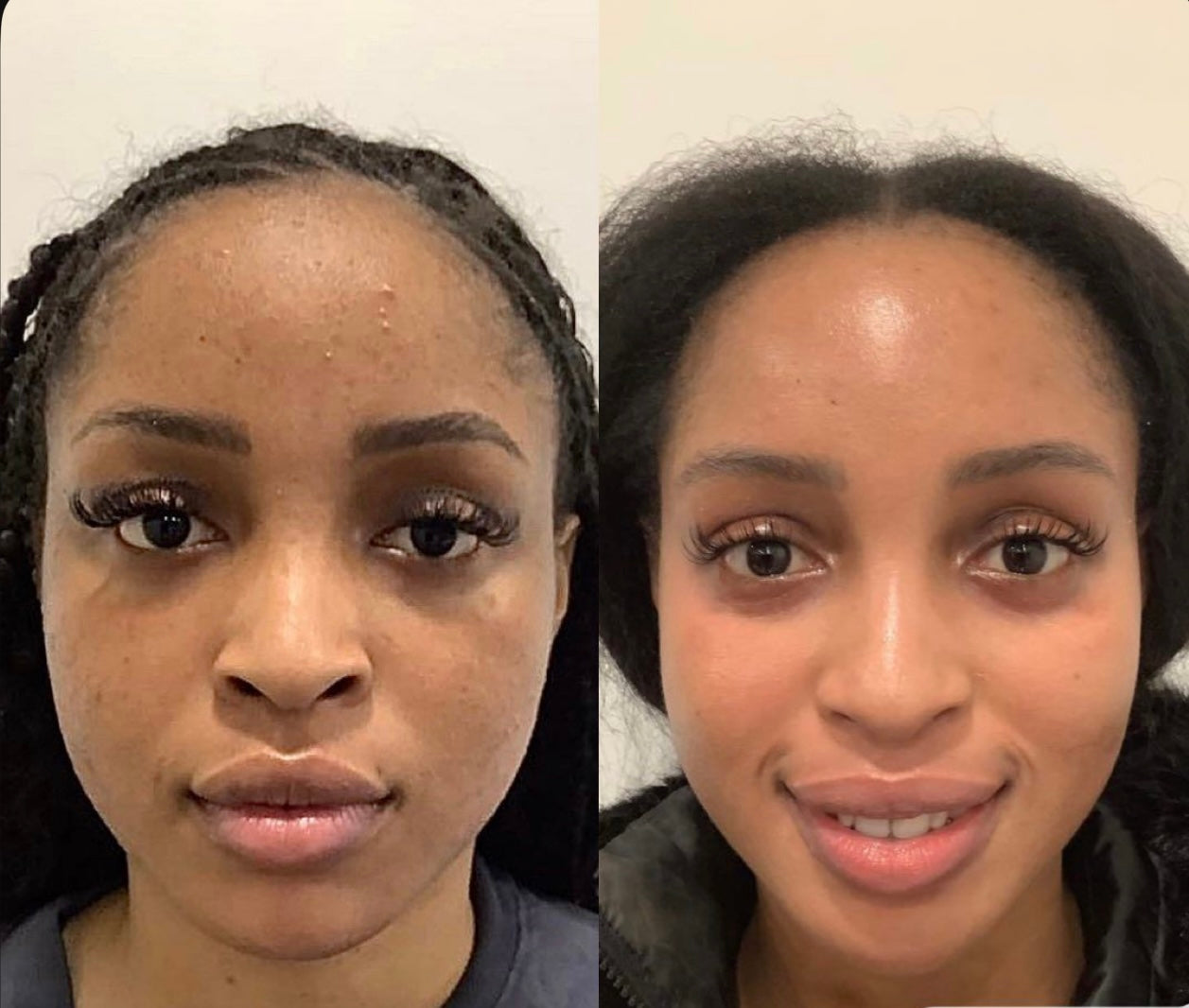 Melanin Skin Care Routine GLO *See Results in less than a week*