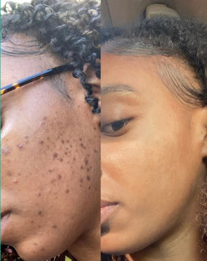 Melanin Skin Care Routine GLO *See Results in less than a week*